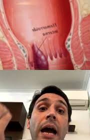 LINDISIMA charla con el dr Alejandro Canela