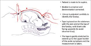 diagnosis of intrauterine growth restriction cherian ag