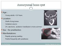 Aneurysmal bone cysts (abcs), which are benign lesions of the bone, primarily affect pediatric patients. Image Result For Aneurysmal Bone Cyst In The Jaws Oral Pathology Cysts Jaw Bone