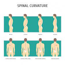 Symptoms may include fever, urinary tract infection (uti), kidney infection, and blood or pus in the urine. Lower Back Pain Causes Treatments Exercises Back Pain Relief
