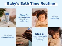 Image result for Cradle Cap