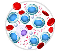 The next section in this guide is diagnosis. What Is Another Name For Blood Cancer