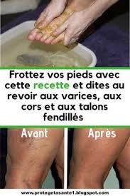 Pin On Beaute Du Corps