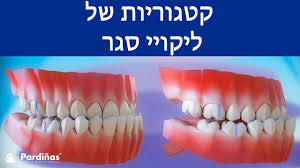 Jun 13, 2021 · חיזוק להגנה: ×§×˜×'×•×¨×™×•×ª ×©×œ ×œ×™×§×•×™×™ ×¡×'×¨ Youtube