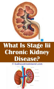 Pin On Kidney Disease Food