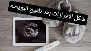 شكل الافرازات بعد تلقيح البويضة هل تتوقف الافرازات بعد تلقيح البويضة Youtube