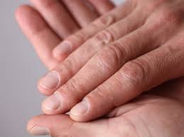 What causes black spot on toenail. Black Line On The Nail Causes Treatments Pictures And More