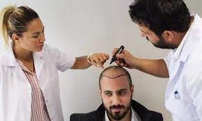 10 تجارب ونصائح لزراعة الشعر في الرياض دكتور زد