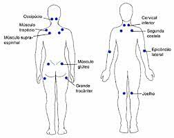 Esses locais são pontos previamente estabelecidos em que se observa a sensação de dor no paciente. Fibromialgia A Dor Cronica Dor No Corpo Todo Fibromialgia Sintomas Da Fibromialgia Fibromialgia Sintomas