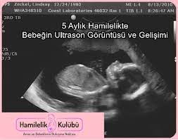 5 aylik gebelik ultrason goruntuleri bebegin durumu sagligi boyu kilosu gelisimi bebegimiz hamileligin 5 ayinda hangi mey hamilelik 5 aylik bebek saglik