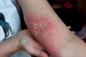 Maybe you would like to learn more about one of these? Signs And Symptoms Of Tattoo Infection And What To Do About It