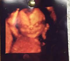 This cutting edge imaging is also known as 5d ultrasound. Check My Pinned Tweet On Twitter Apparently A 4d Ultrasound Can Make Your Baby Look Like A Demon Http T Co G7llnickkw Http T Co Ijwpssafq9