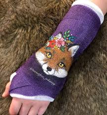 Fox Floral Cast Art Hand Painted Design Using Acrylic Paint Broken Fractured Wrist Colorful Flowers Red Fox Art On Broken Hand Cast Cast Art Arm Cast