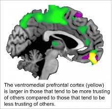 Brain Structure Varies Depending On How Trust | Eurekalert!