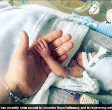 Nesta semana você provavelmente vai sentir que tudo te irrita, até sua própria sombra e está esperando ansiosamente o dia d. Bebe Que Nasceu De 22 Semanas E Menor Que A Palma De Uma Mao Desafia Os Medicos Ele E Nosso Milagre Fotos R7 Saude