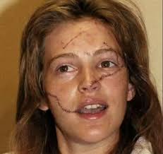 We've said it once, and we'll say it again—WHO THE F*CK LIES ABOUT HAVING  CANCER?! This week, Susie sits down with investigative producer Nancy  Moscatiello to unpack the shocking case of Amanda