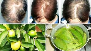 Bu Yapraklar 100 Sac Dokulmesini Durdurur Ve Saclarinizi Hizli Buyutur Guava Leaves For Hair Help Hair Loss Guava Leaves