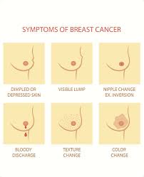 Any sudden changes in the texture or appearance of for all females out there, it is important to have a clear picture of the symptoms of various types of breast cancers. Breast Cancer Symptoms Singapore I Have A Breast Lump Is It Cancer