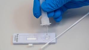 Ein antikörper schnelltest erfasst nicht das virus selbst, sondern die reaktion des immunsystems auf den erreger. Hamburg Arbeitet An Strategie Fur Corona Schnelltests Ndr De Nachrichten Hamburg