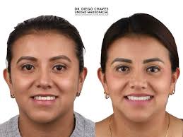 Diego Chaves (@unidadmaxilofacial) • Instagram photos and videos