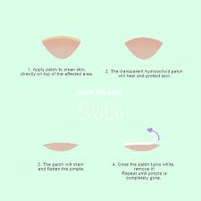 You can diy a pimple patch in 4 steps! Guide For Our Perfect Pimple Patch Cystic Acne Treatment Diy Acne Treatment Homemade Acne Treatment