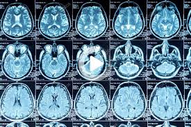 Mri Scan Of The Brain In 2020 Mri Scan Mri Food Illustration Art