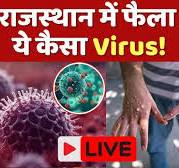 Rajasthan New Disease: राजस्थान में फैली ये कैसी बीमारी, ऐसे करें बचाव!।  Virus । Viral । Health News