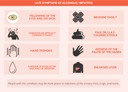 Image result for hepatitis symptoms