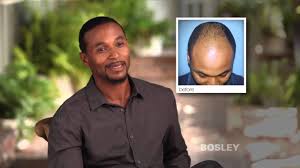 Bosley's hair regrowth treatment for men is clinically proven to regrow hair and slow down further hair loss. How Much Does Bosley For Men Cost