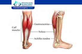 How to heal achilles tendon faster. Achilles Tendon Repair Surgery Cost In Iran Iranian Surgery