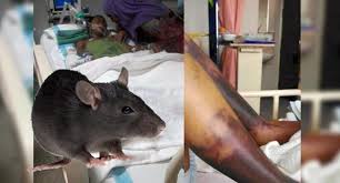 Jika tidak dirawat segera, penyakit ini boleh. Waspada Ancaman Penyakit Kencing Tikus Di Sekitar Anda