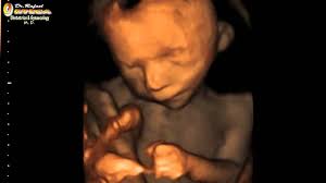 Maybe you would like to learn more about one of these? 4d Ultrasound 21 Weeks Pregnant Face 4d Rafael Ortega Munoz Md Ciudad Real In 2021 4d Ultrasound 21 Weeks Pregnant Ultrasound