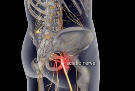 Spine diagram showing back pain. Low Back Pain Pictures Symptoms Causes Treatments