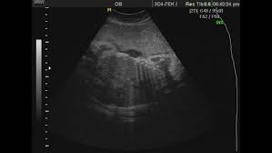 In The Utero An Infant Stock Footage Video 100 Royalty Free 9228377 Shutterstock