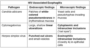 Hsv esophagitis is usually identified in patients with aids or viral causes of esophagitis include cmv and hsv.52 esophageal disease caused by bacteria radiographic differentiation of various types of esophageal ulcerative disease (e.g., candidiasis vs. Pin On Medicina