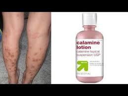 Replace with a bath using a baking soda mixture. Pin On Execure