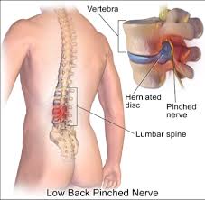 Sala de operatie neurochirurgicala cu masa de operatie cel mai in varsta pacient din cadrul sectiei noastre a avut varsta de 104 ani! Radiculopatie Lombara Sciatica Durerea Pe Picior Dr Dan Martin