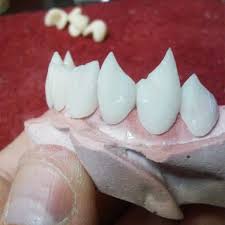 Permanent options, on the other hand, will be made from genuine dental polymers. This Guy Is Proving 70 Custom Vampire Fangs Aren T Just For Halloween Anymore Inc Com