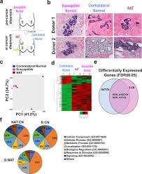 She says oggy had been giving her warning signs of the malignancy for months before she found the lump herself and was diagnose with. Upregulation Of Lipid Metabolism Genes In The Breast Prior To Cancer Diagnosis Npj Breast Cancer