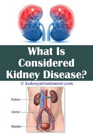 Pin On Kidney Disease