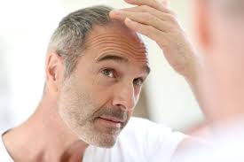 Turkey has emerged as one of the market leaders in this field worldwide. Pick A Trusted Hair Transplant Center In Turkey The Natural Tips