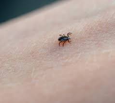 Image result for Tick Removal