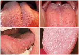 How do i get them back? What Do Your Taste Buds Look Like