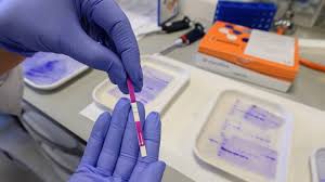 Cuanto Duran En La Sangre Los Anticuerpos Contra El Coronavirus As Com