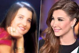 ليلى اسكندر قبل وبعد عمليات التجميل. Ù†Ø¬Ù…Ø§Øª Ù‚Ø¨Ù„ ÙˆØ¨Ø¹Ø¯ Ø§Ù„ÙÙŠÙ„Ø± Ù„Ø§Ø­Ø¸ÙˆØ§ Ø§Ù„ÙØ±Ù‚ Ø§Ù„ØµØ§Ø¯Ù… Ù…Ø¬Ù„Ø© Ø³ÙŠØ¯ØªÙŠ