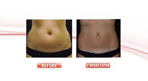 All surgical procedures are performed by cosmetic . Before After Cosmetic Surgery Medical Face Body Aesthetics