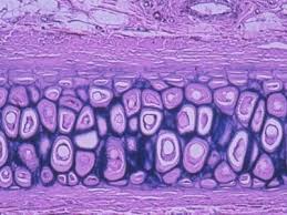These fibers form bundles that appear dark under a microscope. 11 Elastic Cartilage Ideas Outer Ear Cartilage Inner Ear