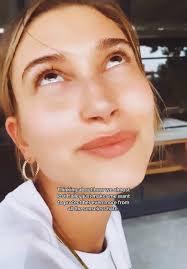 Hailey Bieber Almost Died