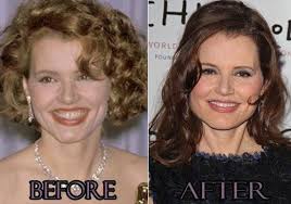 Geena Davis Plastic Surgery Before After Pictures Davis Geena Pictures Plastic Surgery Celebrity Plastic Surgery Plastic Surgery Photos Geena Davis
