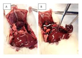 The gallbladder is located in the upper right abdomen just under the liver and rib. Semi Minimal Invasive Method To Induce Myocardial Infarction In Rats And The Assessment Of Cardiac Function By An Isolated Working Heart System Protocol